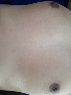 Lồn nhiều lông
