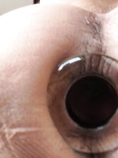 THẤU